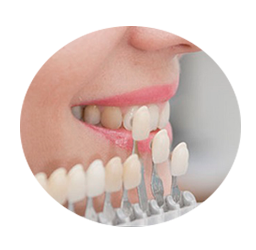 Implantes dentales Las rozas: tipos de coronas dentales