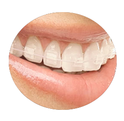 ortodoncia-en-zafiro